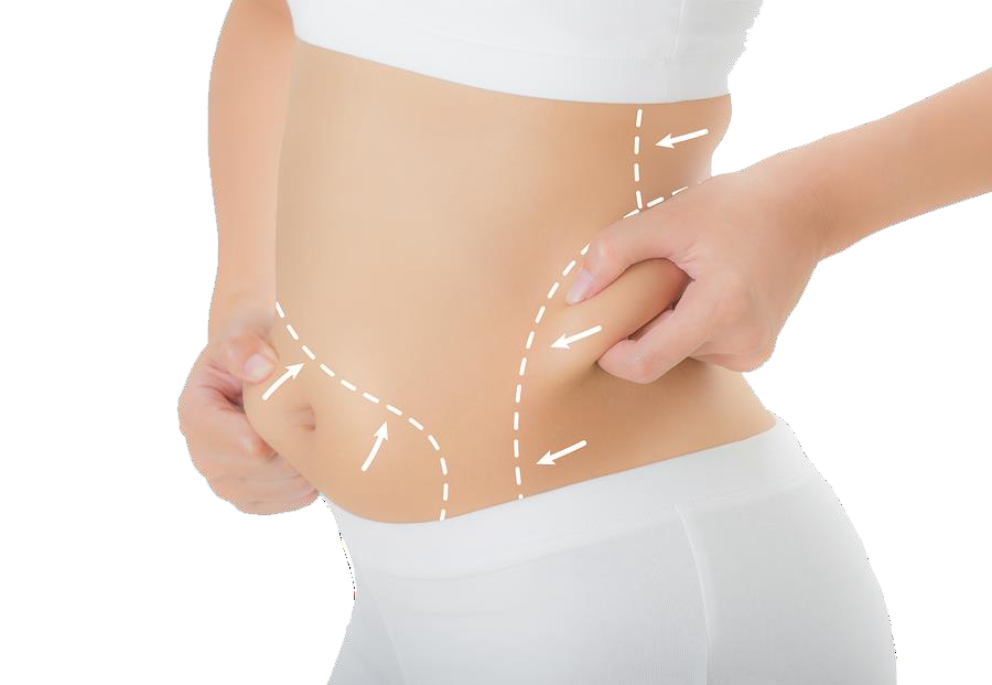 liposuction in bangalore